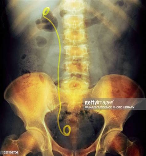 Excretory Organs Photos And Premium High Res Pictures Getty Images