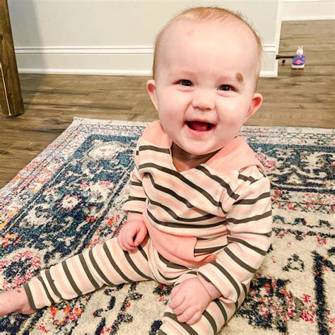 Neurocutaneous Melanosis and Giant Congenital Melanocytic Nevus: Addie