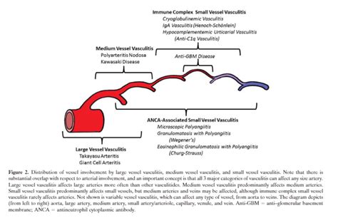 Table 3 Definitions For Vasculitides Adopted By The 2012 International Chapel Hill Consensus