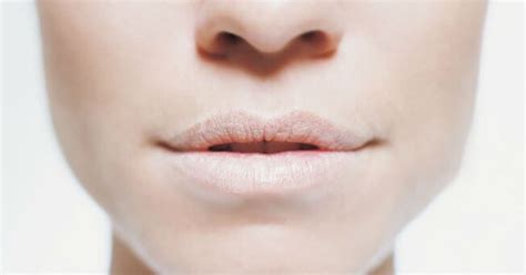 ¿por Qué Se Resecan Los Labios — Mejor Con Salud