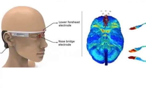 Scientists Invented A Wearable Device That Can Prevent Alzheimer’s Disease Impact Lab