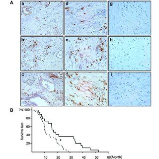 Stromal fibroblast activation protein-α (FAP) expression in resected ... 