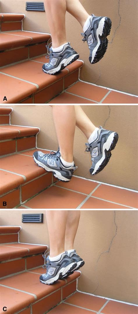 Tendinopathy causes, symptoms, diagnosis, treatment and exercises