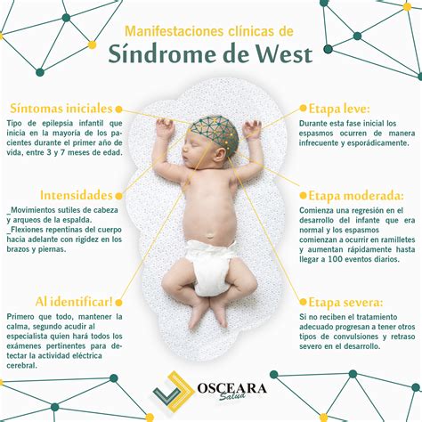 Síndrome De West Pode Matar - Síndrome de West - Osceara