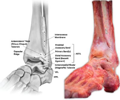 Ankle Syndesmosis Injuries Assessment Rayner Smale