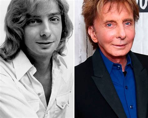 Did Barry Manilow Have Plastic Surgery Transformation Photos Barry