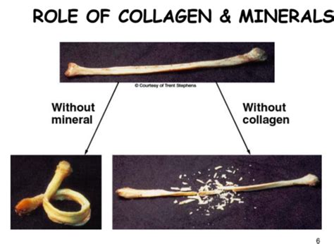 Bone Axial Skeleton And Calcium Regulation Terms List Flashcards