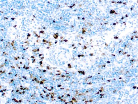 Diagnostic Biosystems MYELOPEROXIDASE Myeloperoxidase, Quantity: Each ...