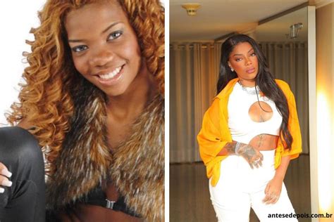 Ludmilla Antes E Depois Da Cantora Ap S Cirurgias