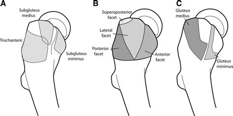 Lateral Hip Us