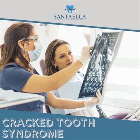 Cracked Tooth Syndrome Is More Than Just Mere Obvious Cracks On Your