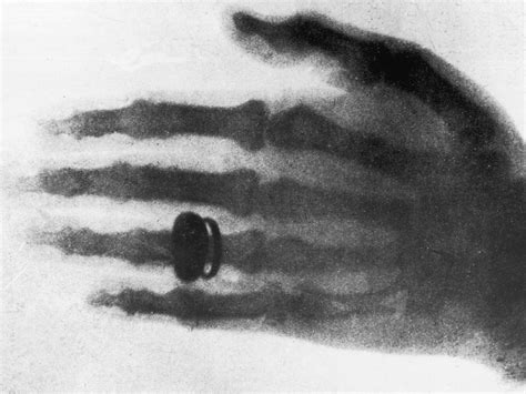 The first X-ray photograph : Rhodri Marsden's Interesting Objects No.86