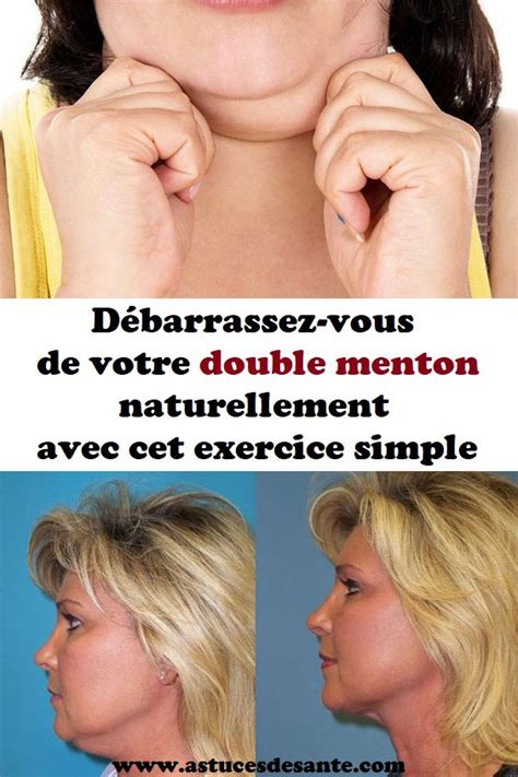 Débarrassez vous de votre double menton naturellement avec cet exercice