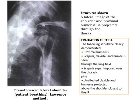 Shoulder Girdle Presentation