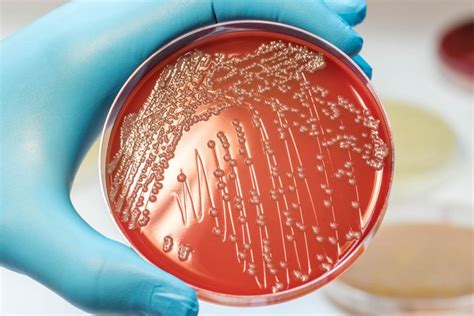 Escherichia coli síntomas diagnóstico y cura Emergency Live