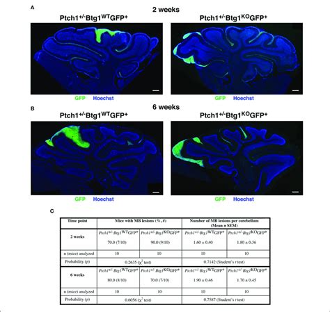 Deletion Of The B Cell Translocation Gene Btg Gene In Patched