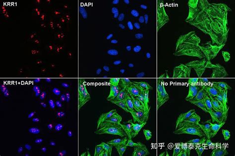 超全攻略 一文理清免疫荧光实验步骤技巧及疑难问题 知乎