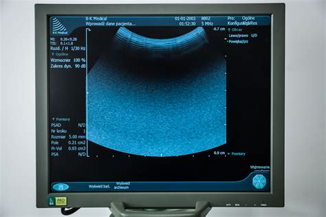 Bk Medical Sonda Usg G Owica Convex Arestomed