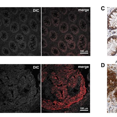 Indirect Immunofluorescence Analysis Of Differentially Expressed