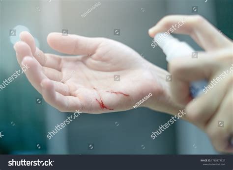 3,062 Disinfect wounds Images, Stock Photos & Vectors | Shutterstock