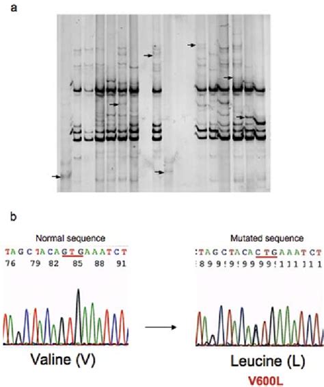 Figure From Nras And Braf Mutation Frequency In Primary Oral Mucosal