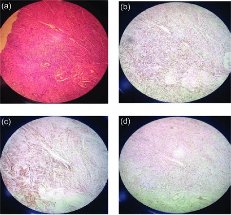 A Hematoxylin And Eosin Staining Of Specimen And Immunohistochemical