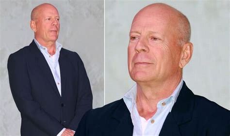 Bruce Willis’ Aphasia Explained Symptoms Of The Star S Condition Uwinhealth