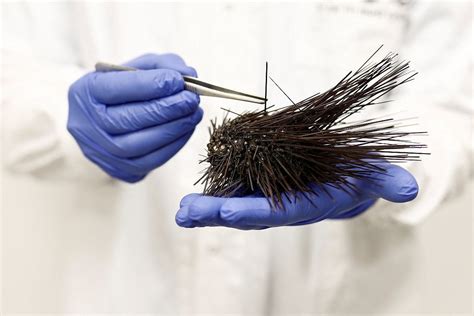 Red Sea Epidemic Kills Off Sea Urchins Imperiling Coral The Japan News