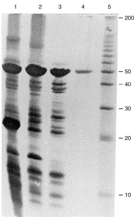 SDSPAGE Analysis Of Protease Purication From Pseudomonas Uorescens