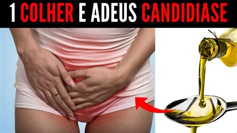 Faça Apenas Essas 4 Receitas Para Acabar Com A CandidÍase E Corrimento Vaginal Youtube