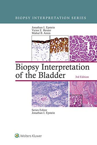 Read Biopsy Interpretation of the Bladder (Biopsy Interpretation Series)