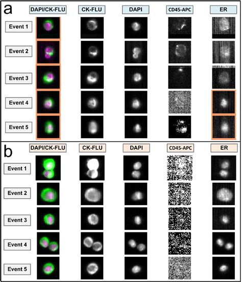 Figure 2 From Detection Of Activating Estrogen Receptor Gene Esr1 Mutations In Single