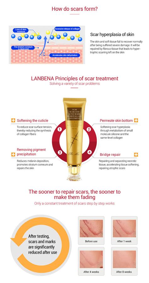 remove scars acne scar repair cream scar removal cream