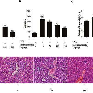 Specnuezhenide Alleviates Ccl Induced Liver Injury In Mice Levels