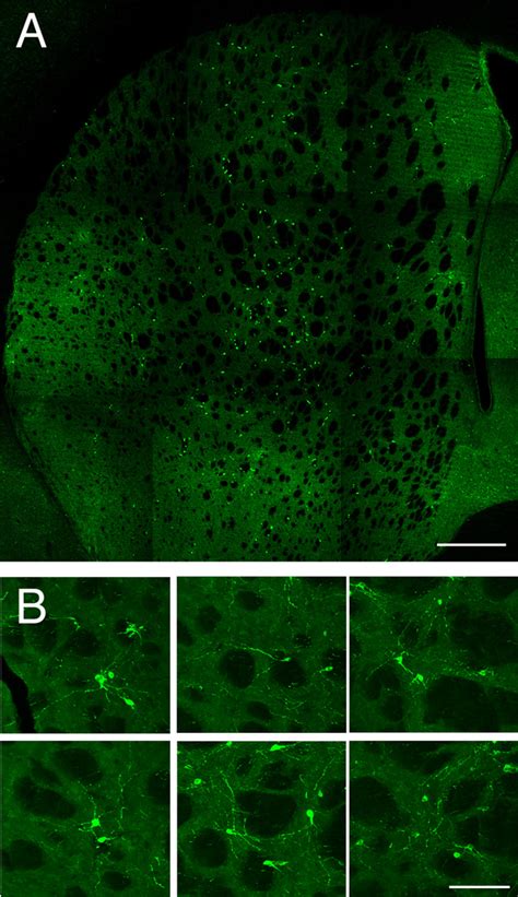 Figure 1 From Embryonic MGE Precursor Cells Grafted Into Adult Rat