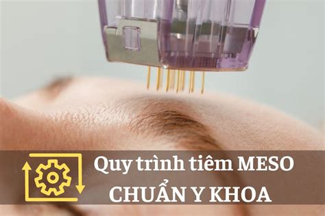 Quy Trình Tiêm Meso Bước đột Phá Trong Thẩm Mỹ Và Chăm Sóc Da