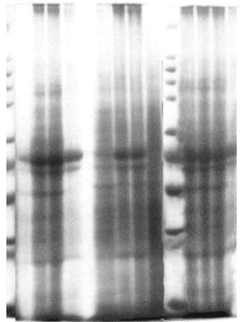 Sds Page Pattern Of Total Proteins In Vorticella Microstoma Lanes