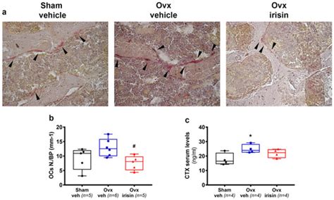 IJMS Free Full Text Irisin Protects Against Loss Of Trabecular Bone