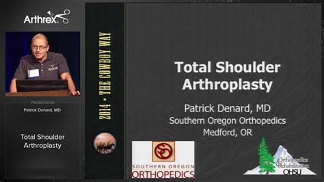 Arthrex Total Shoulder Arthroplasty