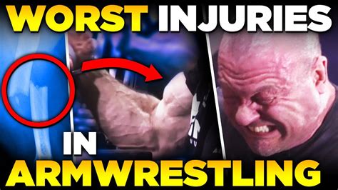 Top 3 Worst Armwrestling Injuries and How To Prevent Them - YouTube