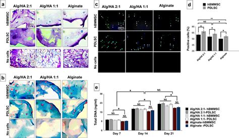 In Vitro Chondrogenic Differentiation Of Encapsulated Mscs The Download Scientific Diagram