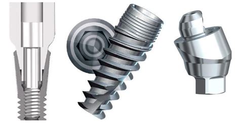 Comparison Of Implantabutment Connection Types