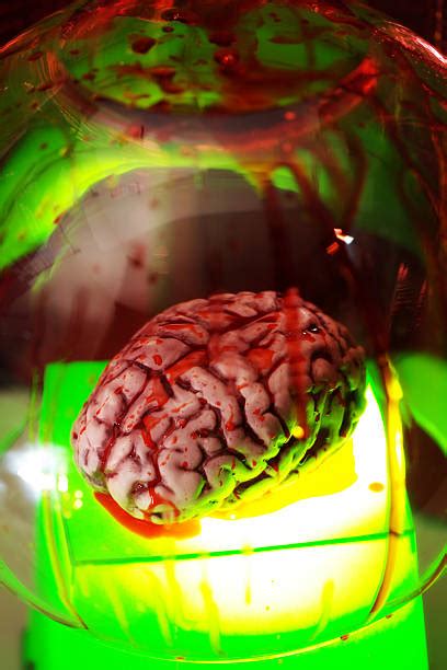 70+ Brain Autopsy Stock Photos, Pictures & Royalty-Free Images - iStock