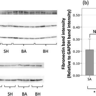 Western Blot Evaluation Of Extracellular Matrix Component Proteins A