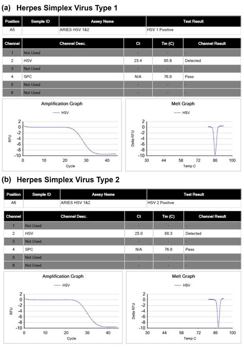 Genital Herpes Simplex Type 2