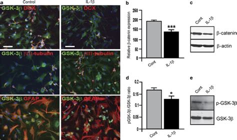 The effect of IL 1β on glycogen synthase kinase 3β GSK 3β activity in