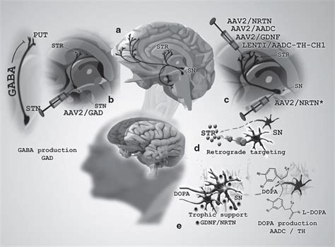 Parkinsons Disease Gene Therapy Success By Design Meets Failure By