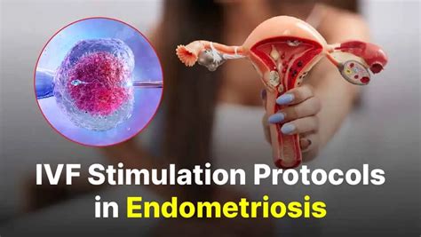 Ivf Stimulation Protocols In Endometriosis Dr Jay Mehta