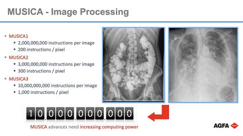 Universal Imaging AGFA MUSICA 3 YouTube