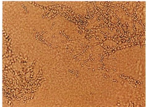 克柔念珠菌 综合性临床细胞学图 医学